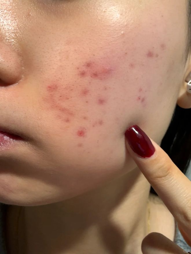 久没换了？这种毛巾建议马上换掉不朽情缘游戏平台你家的毛巾多(图14)